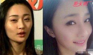 陈冰整容了吗 陈冰妈妈整容前照片