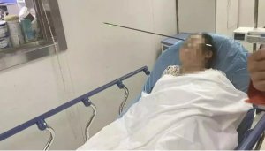 女子小区散步遭遇“暗箭”！80 厘米长箭射穿脸部