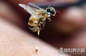 被蜜蜂蛰了怎么办，首先要拔出毒针(叫你怎样处理被蜇伤口)
