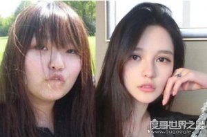 看到周扬青前后对比我惊了，整容界的扛把子
