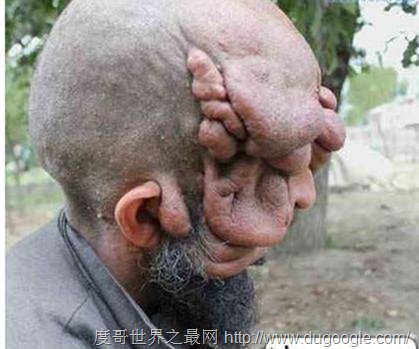 世界上最丑的男人，乌干达最丑男人取2个老婆生8个孩子