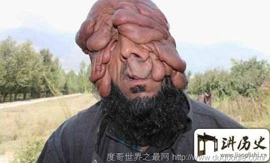 世界上最丑的男人，乌干达最丑男人取2个老婆生8个孩子