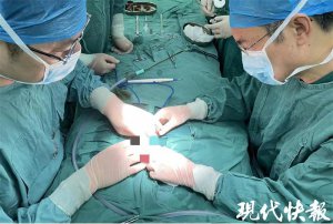 ​险！“巴掌大”的早产儿腹胀，一查是肠穿孔