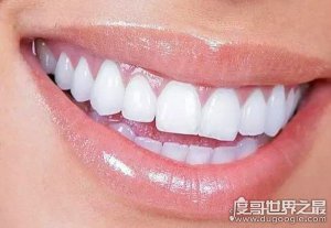 ​世界上牙齿最多的人，印度一小伙长出37颗牙(比常人多出5颗)