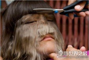 ​世界上毛最多的人是谁，艾米丽·苏珊(返祖现象所致)