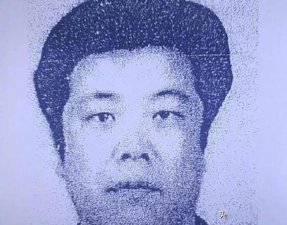 ​素媛案件真实女孩怎么样了 终身携带人造肛门生活