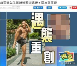​港星黄竣锋被人砍成重伤，古天乐赠 5 万港元救急