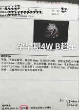 ​刚二婚就怀孕，孩子不是老公的？