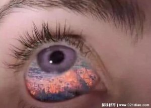 ​真实人的阴阳眼图片，看了晚上会噩梦的(胆小慎入)