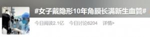 ​吓人！90 后姑娘戴 10 年隐形眼镜，角膜上“爬满”……