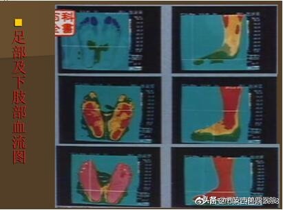 足底按摩图(足底按摩图反射区图片的功效)-图9