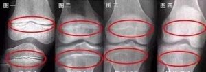 ​女孩初潮以后还能长高吗(女孩子月经初潮后还能长高吗)