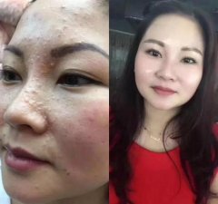 ​敏感肌卸妆水好还是卸妆油好用(敏感肌用卸妆水好还是卸妆油好)
