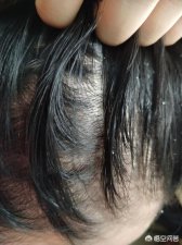 ​油性头发怎么护发(油性发质要用护发素吗)