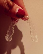 ​怎么治疗磨牙简单办法(治疗睡觉磨牙小妙招)