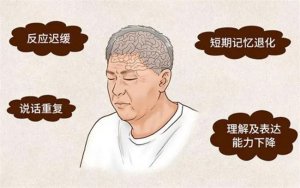 ​痴呆症的早期症状表现有那些
