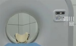 ​阳后是不是要拍肺部CT吗？
