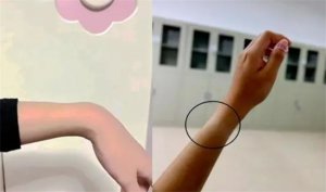 ​多人称戴苹果手表“手凹了” 客服怎么说？