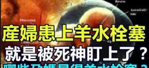​羊水栓塞是剖腹产吗(羊水栓塞发生在顺产还是剖腹产)