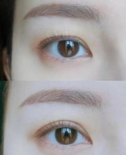 ​贴双眼皮贴真的可以变成双眼皮吗?(双眼皮后果)