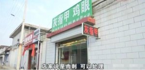 ​女子脚底板扎进刺（女子脚底三个肉刺拔出4600根）