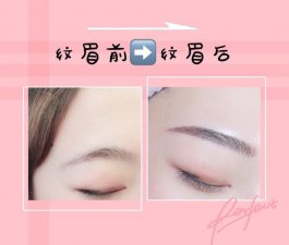 ​去纹眉需要注意哪些（看完这个再决定）