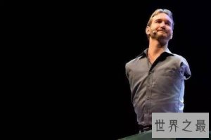 ​世界上最著名的十大残疾名人，值得所有人学习。