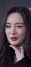 ​杨幂的眼睛怎么了？出现怪异褶皱双眼不对称，再引网友整容质疑