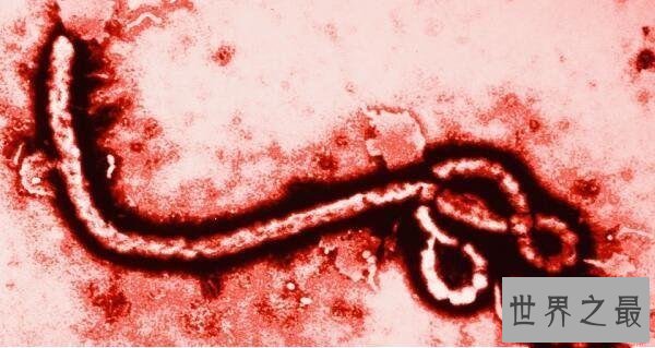 世界上10大最恐怖的病毒，第一让近数亿人死亡，艾滋病仅第五