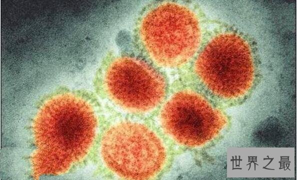 世界上10大最恐怖的病毒，第一让近数亿人死亡，艾滋病仅第五