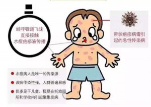 ​水痘 认识水痘，一起“战痘”